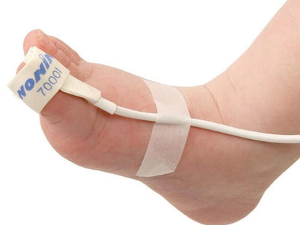 Nonin Infant Flexi-form II Wrap Sensor x24